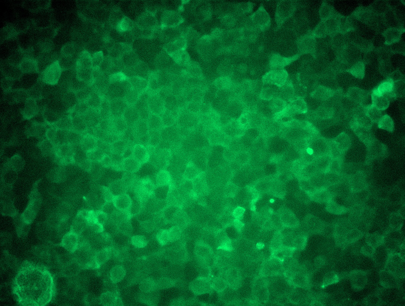 <a href = "https://www.origene.com/catalog/cdna-clones/expression-plasmids/rc201201l1-psmd11-nm-002815-human-tagged-lenti-orf-clone" title="RC201201L1" class="">RC201201L1</a> was used to prepare Lentiviral particles using <a href = "https://www.origene.com/catalog/others/lentiviral-packaging-kits/tr30037-lentiviral-packaging-kits" title="TR30037" class="">TR30037</a> packaging kit. HEK293T cells were transduced with RC201201L1V particle to overexpress human PSMD11-Myc-DDK fusion protein.