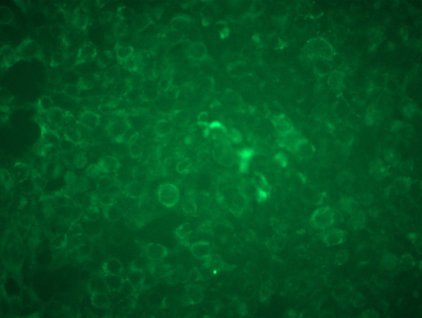 <a href = "https://www.origene.com/catalog/cdna-clones/expression-plasmids/rc201917l3-angptl2-nm-012098-human-tagged-lenti-orf-clone" title="RC201917L3" class="">RC201917L3</a> was used to prepare Lentiviral particles using <a href = "https://www.origene.com/catalog/others/lentiviral-packaging-kits/tr30037-lentiviral-packaging-kits" title="TR30037" class="">TR30037</a> packaging kit. HEK293T cells were transduced with RC201917L3V particle to overexpress human ANGPTL2-Myc-DDK fusion protein.