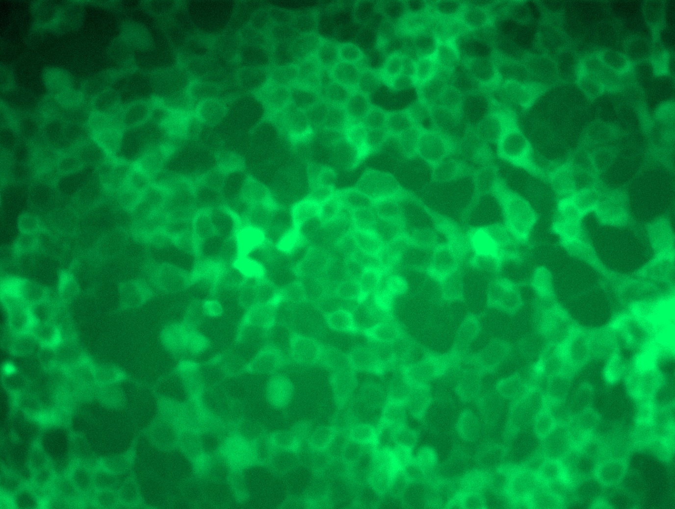 RAF1 (NM_002880) Human Tagged ORF Clone Lentiviral Particle