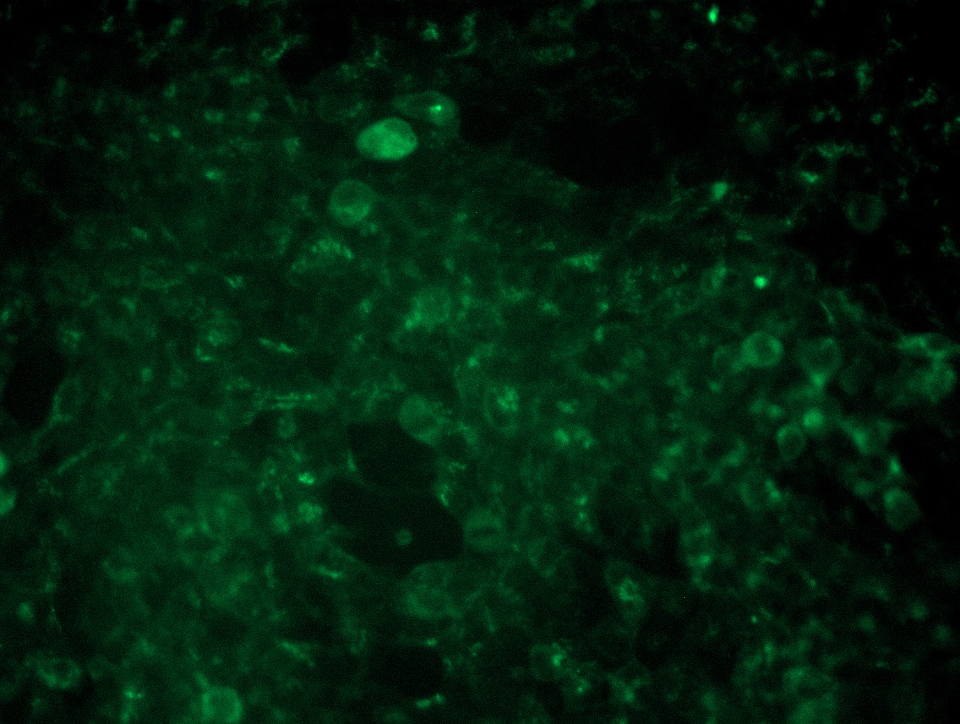 <a href = "https://www.origene.com/catalog/cdna-clones/expression-plasmids/rc202078l3-il6-nm-000600-human-tagged-lenti-orf-clone" title="RC202078L3" class="">RC202078L3</a> was used to prepare Lentiviral particles using <a href = "https://www.origene.com/catalog/others/lentiviral-packaging-kits/tr30037-lentiviral-packaging-kits" title="TR30037" class="">TR30037</a> packaging kit. HEK293T cells were transduced with RC202078L3V particle to overexpress human IL6-Myc-DDK fusion protein.