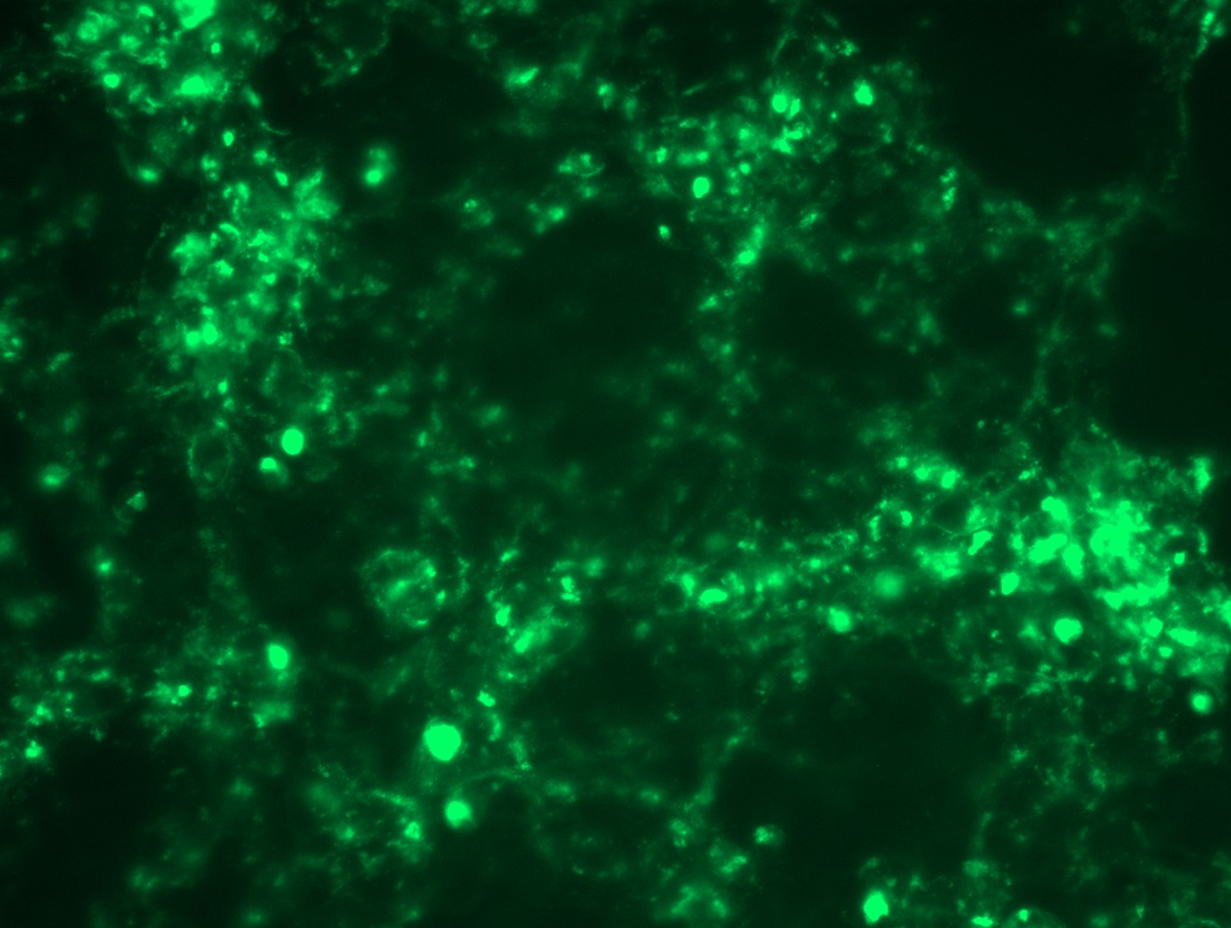 <a href = "https://www.origene.com/catalog/cdna-clones/expression-plasmids/rc202152l4-dr4-tnfrsf10a-nm-003844-human-tagged-lenti-orf-clone" title="RC202152L4" class="">RC202152L4</a> was used to prepare Lentiviral particles using <a href = "https://www.origene.com/catalog/others/lentiviral-packaging-kits/tr30037-lentiviral-packaging-kits" title="TR30037" class="">TR30037</a> packaging kit. HEK293T cells were transduced with RC202152L4V particle to overexpress human TNFRSF10A-mGFP fusion protein.