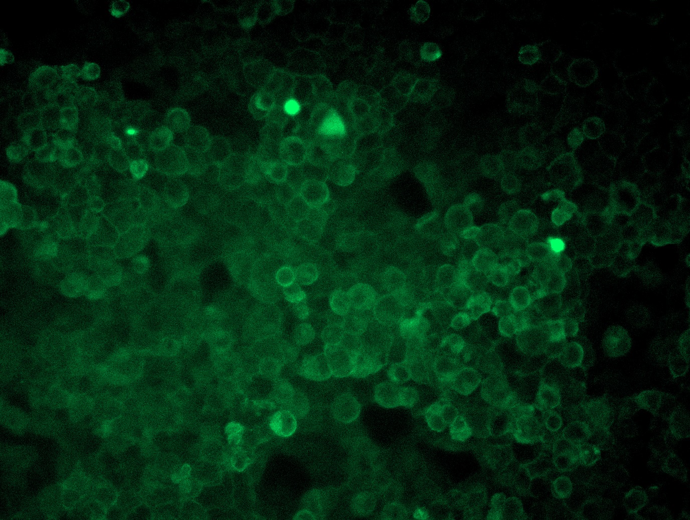 Poliovirus Receptor (PVR) (NM_006505) Human Tagged ORF Clone Lentiviral Particle