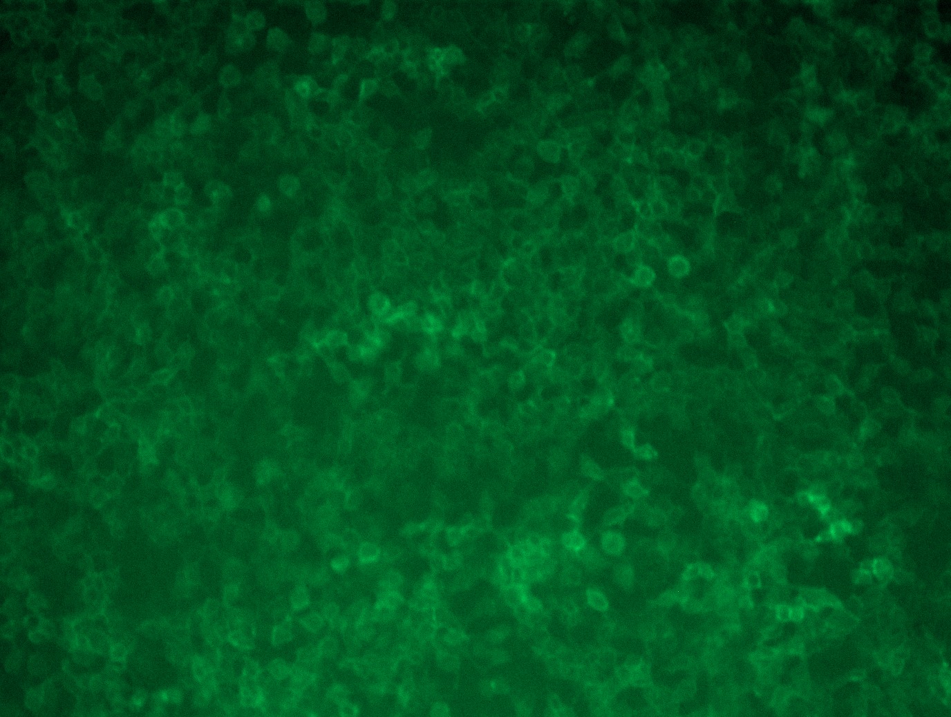 Poliovirus Receptor (PVR) (NM_006505) Human Tagged ORF Clone Lentiviral Particle