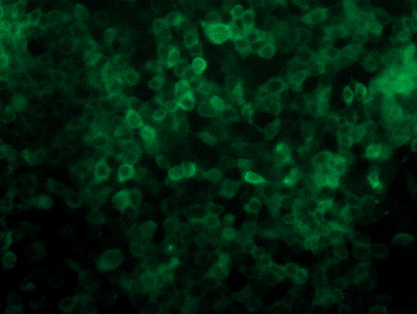 <a href = "https://www.origene.com/catalog/cdna-clones/expression-plasmids/rc202309l4-gapdh-nm-002046-human-tagged-lenti-orf-clone" title="RC202309L4" class="">RC202309L4</a> was used to prepare Lentiviral particles using <a href = "https://www.origene.com/catalog/others/lentiviral-packaging-kits/tr30037-lentiviral-packaging-kits" title="TR30037" class="">TR30037</a> packaging kit. HEK293T cells were transduced with RC202309L4V particle to overexpress human GAPDH-mGFP fusion protein.
