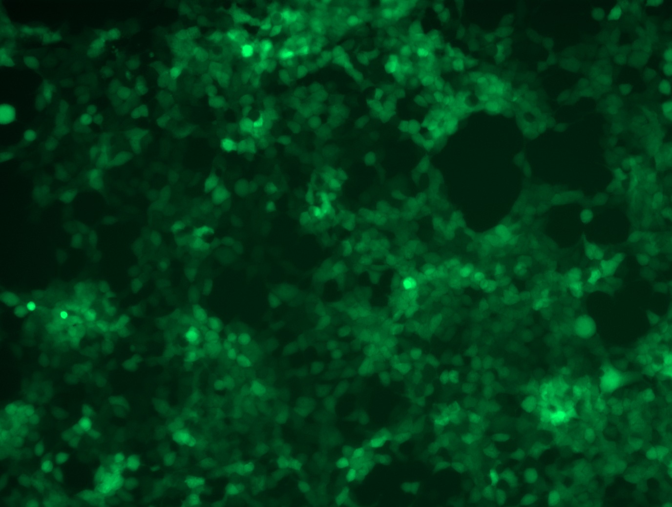 <a href = "https://www.origene.com/catalog/cdna-clones/expression-plasmids/rc202681l2-nras-nm-002524-human-tagged-lenti-orf-clone" title="RC202681L2" class="">RC202681L2</a> was used to prepare Lentiviral particles using <a href = "https://www.origene.com/catalog/others/lentiviral-packaging-kits/tr30037-lentiviral-packaging-kits" title="TR30037" class="">TR30037</a> packaging kit. HEK293T cells were transduced with RC202681L2V particle to overexpress human NRAS-mGFP fusion protein.