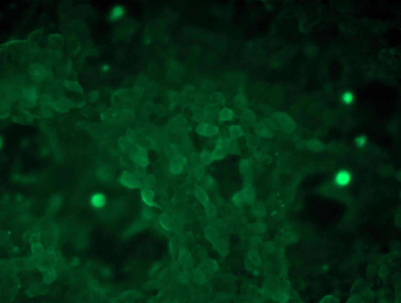 <a href = "https://www.origene.com/catalog/cdna-clones/expression-plasmids/rc202681l3-nras-nm-002524-human-tagged-lenti-orf-clone" title="RC202681L3" class="">RC202681L3</a> was used to prepare Lentiviral particles using <a href = "https://www.origene.com/catalog/others/lentiviral-packaging-kits/tr30037-lentiviral-packaging-kits" title="TR30037" class="">TR30037</a> packaging kit. HEK293T cells were transduced with RC202681L3V particle to overexpress human NRAS-Myc-DDK fusion protein.