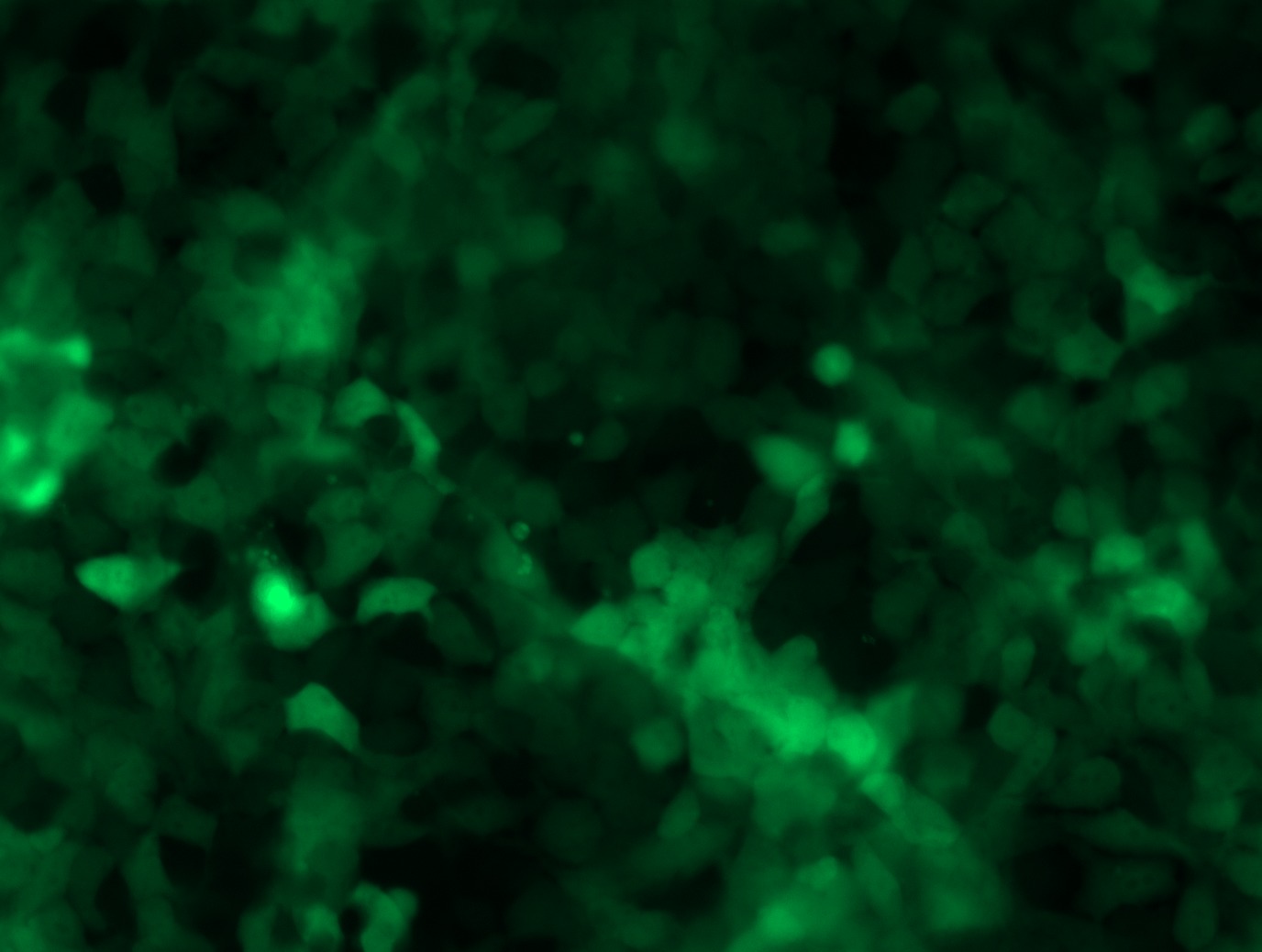<a href = "https://www.origene.com/catalog/cdna-clones/expression-plasmids/rc202681l4-nras-nm-002524-human-tagged-lenti-orf-clone" title="RC202681L4" class="">RC202681L4</a> was used to prepare Lentiviral particles using <a href = "https://www.origene.com/catalog/others/lentiviral-packaging-kits/tr30037-lentiviral-packaging-kits" title="TR30037" class="">TR30037</a> packaging kit. HEK293T cells were transduced with RC202681L4V particle to overexpress human NRAS-mGFP fusion protein.