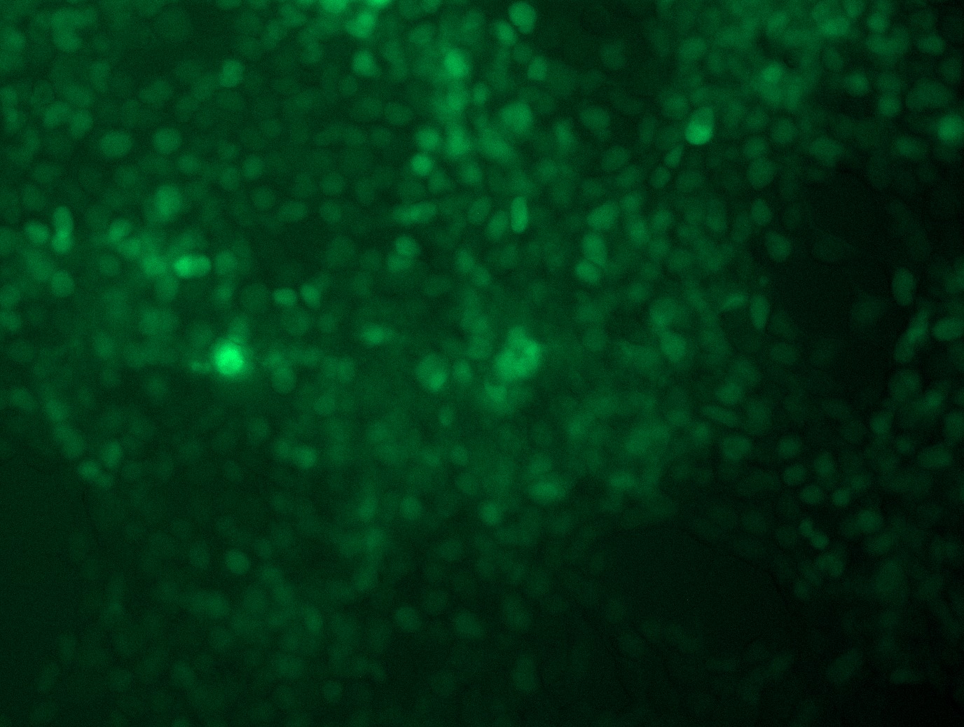 <a href = "https://www.origene.com/catalog/cdna-clones/expression-plasmids/rc202920l4-twist-twist1-nm-000474-human-tagged-lenti-orf-clone" title="RC202920L4" class="">RC202920L4</a> was used to prepare Lentiviral particles using <a href = "https://www.origene.com/catalog/others/lentiviral-packaging-kits/tr30037-lentiviral-packaging-kits" title="TR30037" class="">TR30037</a> packaging kit. HEK293T cells were transduced with RC202920L4V particle to overexpress human TWIST1-mGFP fusion protein.