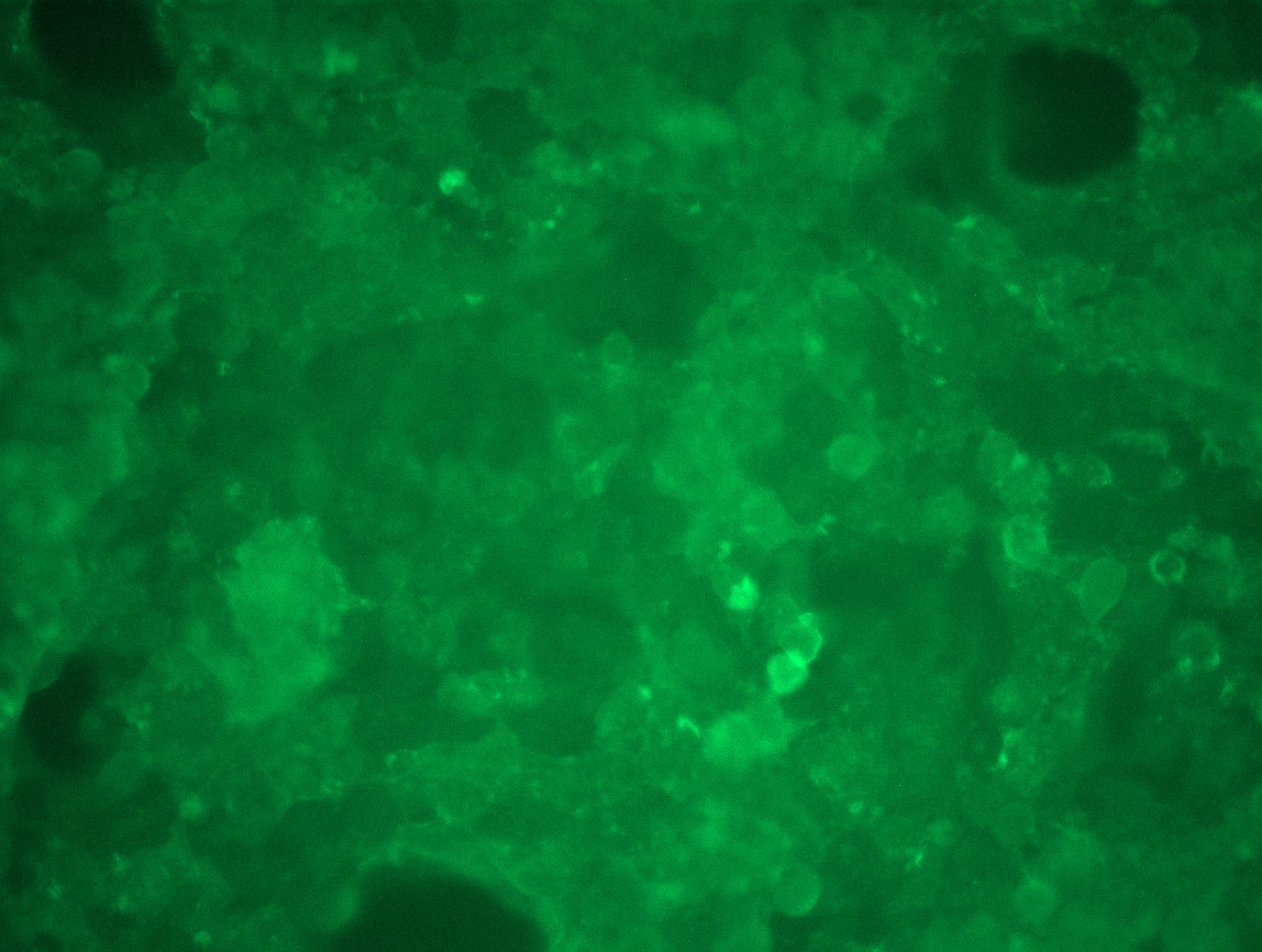 RC202922L3 was used to prepare Lentiviral particles using TR30037 packaging kit. HEK293T cells were transduced with RC202922L3V particle to overexpress human CD19-Myc-DDK fusion protein.