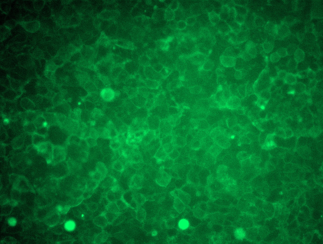 PVRL4 (NECTIN4) (NM_030916) Human Tagged ORF Clone Lentiviral Particle