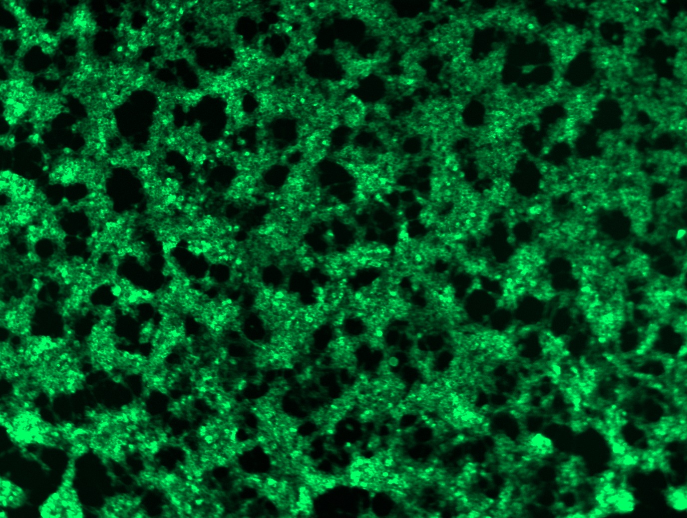 PVRL4 (NECTIN4) (NM_030916) Human Tagged ORF Clone Lentiviral Particle