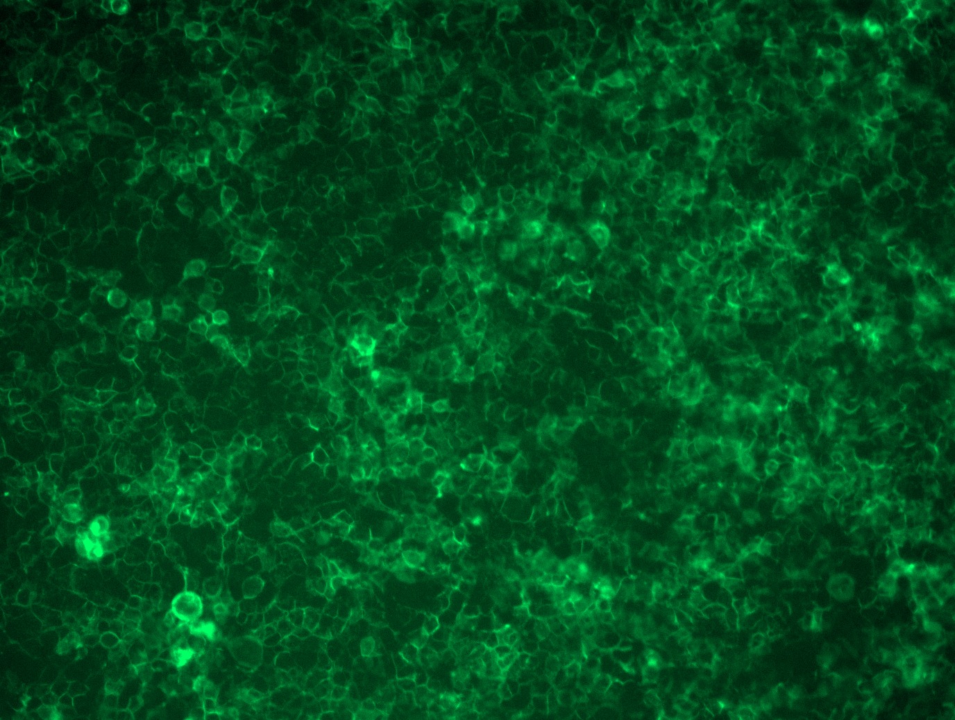 PVRL4 (NECTIN4) (NM_030916) Human Tagged ORF Clone Lentiviral Particle
