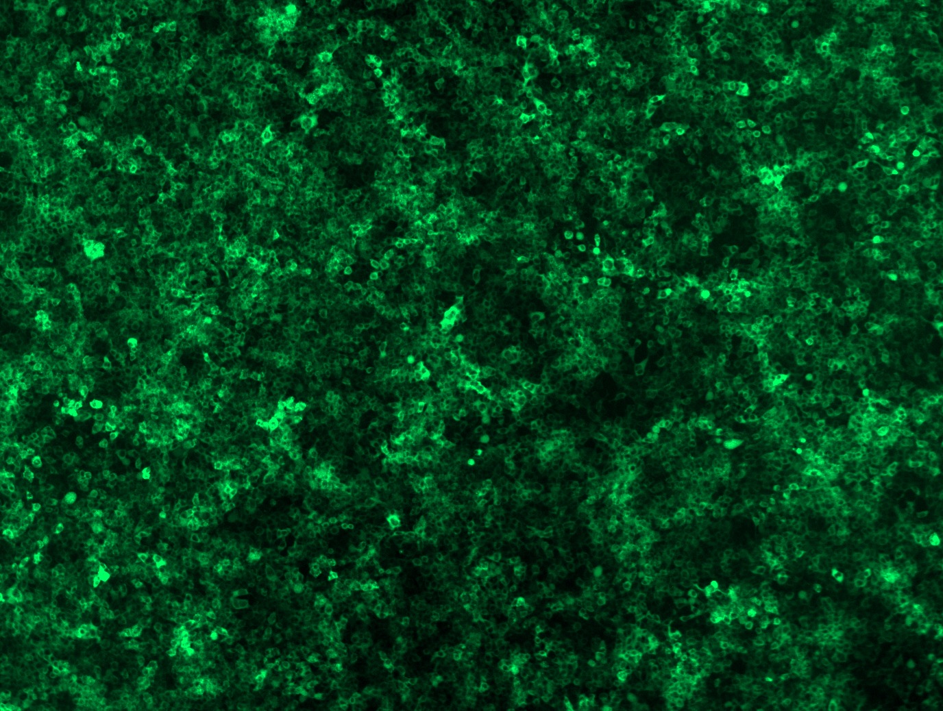 RC203453L4 was used to prepare Lentiviral particles using TR30037 packaging kit. HEK293T cells were transduced with RC203453L4V particle to overexpress human ATG3-mGFP fusion protein.