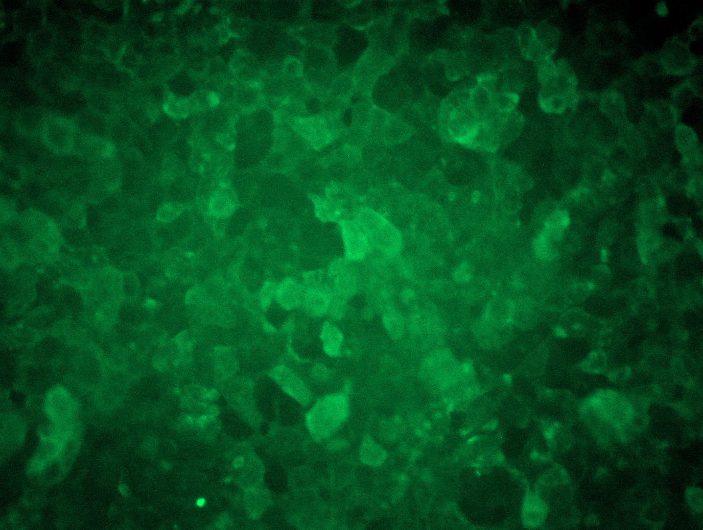 <a href = "https://www.origene.com/catalog/cdna-clones/expression-plasmids/rc203873l3-rab5-rab5a-nm-004162-human-tagged-lenti-orf-clone" title="RC203873L3" class="">RC203873L3</a> was used to prepare Lentiviral particles using <a href = "https://www.origene.com/catalog/others/lentiviral-packaging-kits/tr30037-lentiviral-packaging-kits" title="TR30037" class="">TR30037</a> packaging kit. HEK293T cells were transduced with RC203873L3V particle to overexpress human RAB5A-Myc-DDK fusion protein.