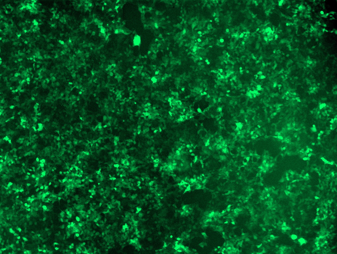 <a href = "https://www.origene.com/catalog/cdna-clones/expression-plasmids/rc203873l4-rab5-rab5a-nm-004162-human-tagged-lenti-orf-clone" title="RC203873L4" class="">RC203873L4</a> was used to prepare Lentiviral particles using <a href = "https://www.origene.com/catalog/others/lentiviral-packaging-kits/tr30037-lentiviral-packaging-kits" title="TR30037" class="">TR30037</a> packaging kit. HEK293T cells were transduced with RC203873L4V particle to overexpress human RAB5A-mGFP fusion protein.
