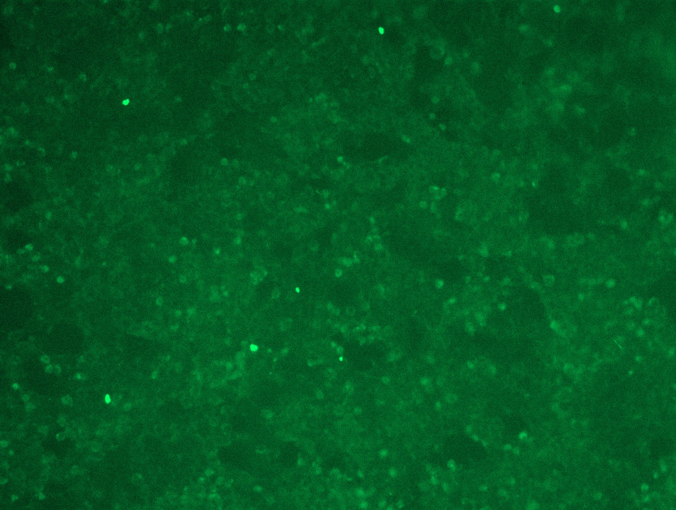 Fibroblast activation protein, alpha (FAP) (NM_004460) Human