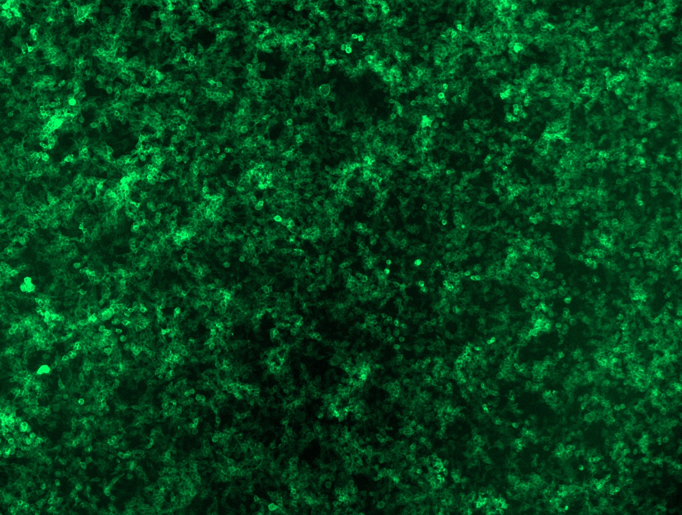 <a href = "https://www.origene.com/catalog/cdna-clones/expression-plasmids/rc206494l4-cd5-nm-014207-human-tagged-lenti-orf-clone" title="RC206494L4" class="">RC206494L4</a> was used to prepare Lentiviral particles using <a href = "https://www.origene.com/catalog/others/lentiviral-packaging-kits/tr30037-lentiviral-packaging-kits" title="TR30037" class="">TR30037</a> packaging kit. HEK293T cells were transduced with RC206494L4V particle to overexpress human CD5-mGFP fusion protein.