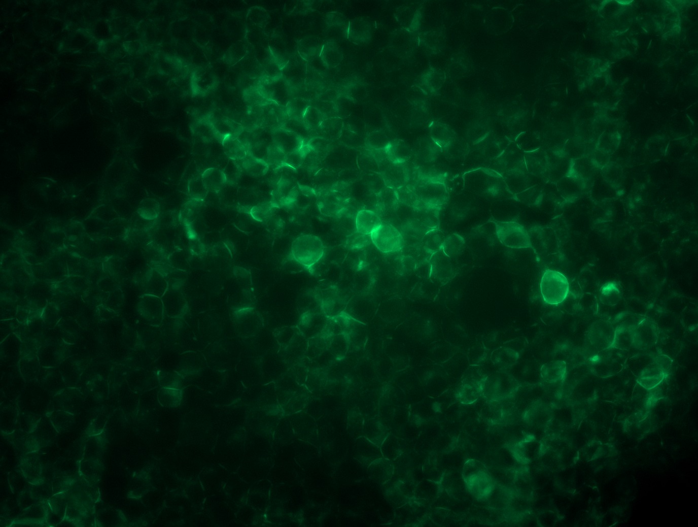 <a href = "https://www.origene.com/catalog/cdna-clones/expression-plasmids/rc207023l4-cd33-nm-001772-human-tagged-lenti-orf-clone" title="RC207023L4" class="">RC207023L4</a> was used to prepare Lentiviral particles using <a href = "https://www.origene.com/catalog/others/lentiviral-packaging-kits/tr30037-lentiviral-packaging-kits" title="TR30037" class="">TR30037</a> packaging kit. HEK293T cells were transduced with RC207023L4V particle to overexpress human CD33-mGFP fusion protein.