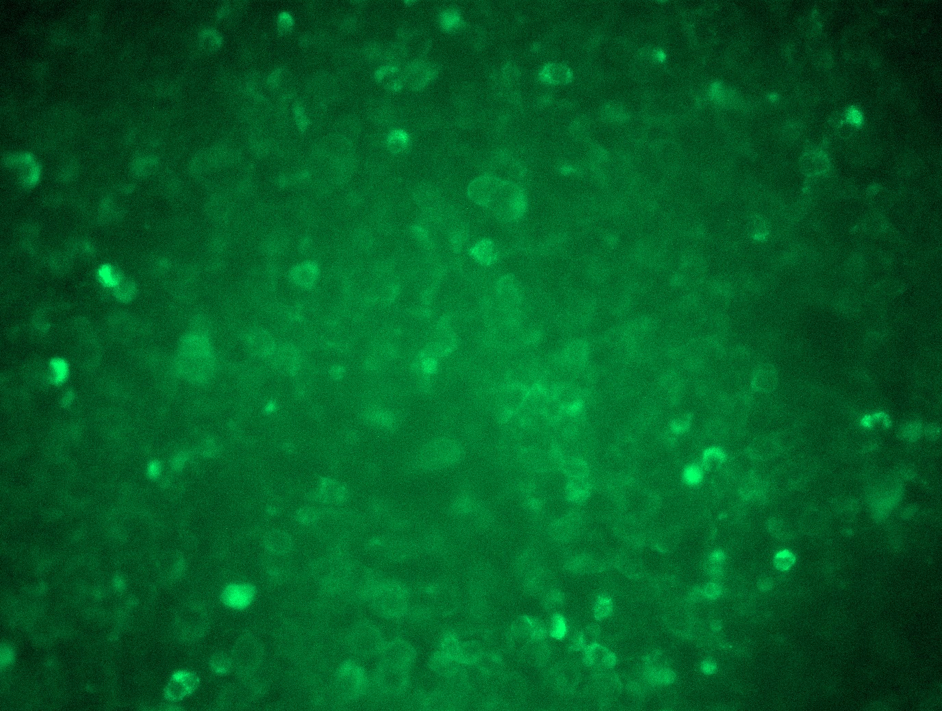 RC207587L3 was used to prepare Lentiviral particles using TR30037 packaging kit. HEK293T cells were transduced with RC207587L3V particle to overexpress human B2M-Myc-DDK fusion protein.