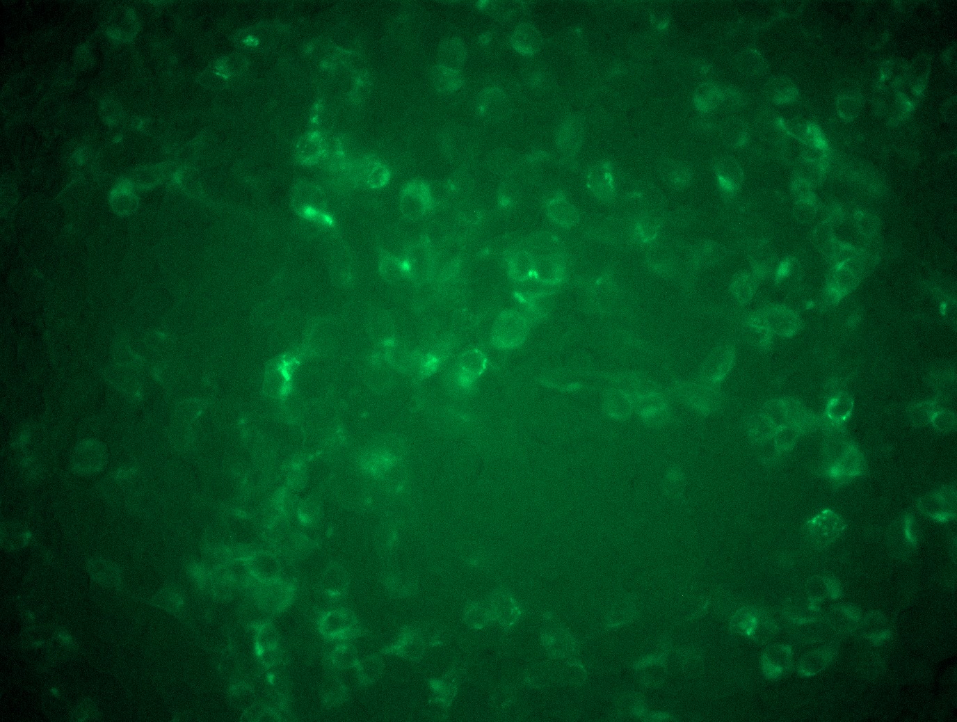 <a href = "https://www.origene.com/catalog/cdna-clones/expression-plasmids/rc208007l4-nadph-oxidase-4-nox4-nm-016931-human-tagged-lenti-orf-clone" title="RC208007L4" class="">RC208007L4</a> was used to prepare Lentiviral particles using <a href = "https://www.origene.com/catalog/others/lentiviral-packaging-kits/tr30037-lentiviral-packaging-kits" title="TR30037" class="">TR30037</a> packaging kit. HEK293T cells were transduced with RC208007L4V particle to overexpress human NOX4-mGFP fusion protein.