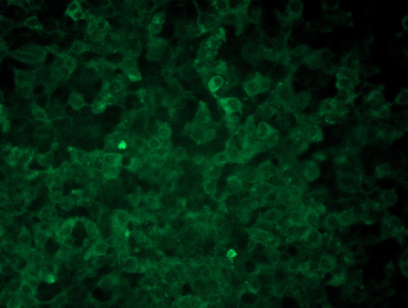 <a href = "https://www.origene.com/catalog/cdna-clones/expression-plasmids/rc208586l3-lat2-slc7a8-nm-012244-human-tagged-lenti-orf-clone" title="RC208586L3" class="">RC208586L3</a> was used to prepare Lentiviral particles using <a href = "https://www.origene.com/catalog/others/lentiviral-packaging-kits/tr30037-lentiviral-packaging-kits" title="TR30037" class="">TR30037</a> packaging kit. HEK293T cells were transduced with RC208586L3V particle to overexpress human SLC7A8-Myc-DDK fusion protein.