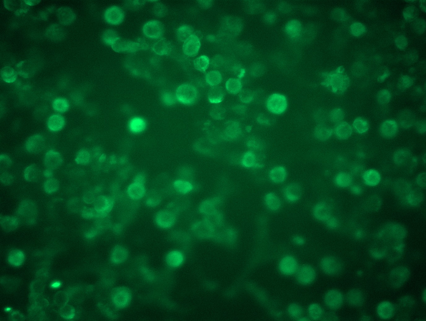 <a href = "https://www.origene.com/catalog/cdna-clones/expression-plasmids/rc208622l3-src-nm-005417-human-tagged-lenti-orf-clone" title="RC208622L3" class="">RC208622L3</a> was used to prepare Lentiviral particles using <a href = "https://www.origene.com/catalog/others/lentiviral-packaging-kits/tr30037-lentiviral-packaging-kits" title="TR30037" class="">TR30037</a> packaging kit. HEK293T cells were transduced with RC208622L3V particle to overexpress human SRC-Myc-DDK fusion protein.