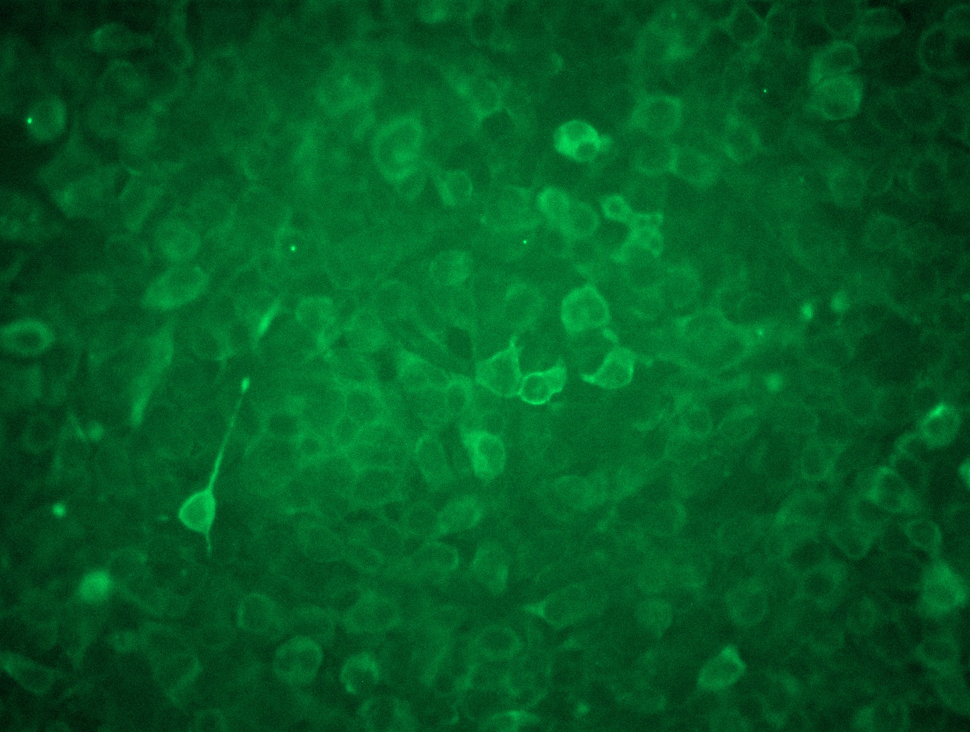 <a href = "https://www.origene.com/catalog/cdna-clones/expression-plasmids/rc208708l3-galns-nm-000512-human-tagged-lenti-orf-clone" title="RC208708L3" class="">RC208708L3</a> was used to prepare Lentiviral particles using <a href = "https://www.origene.com/catalog/others/lentiviral-packaging-kits/tr30037-lentiviral-packaging-kits" title="TR30037" class="">TR30037</a> packaging kit. HEK293T cells were transduced with RC208708L3V particle to overexpress human GALNS-Myc-DDK fusion protein.