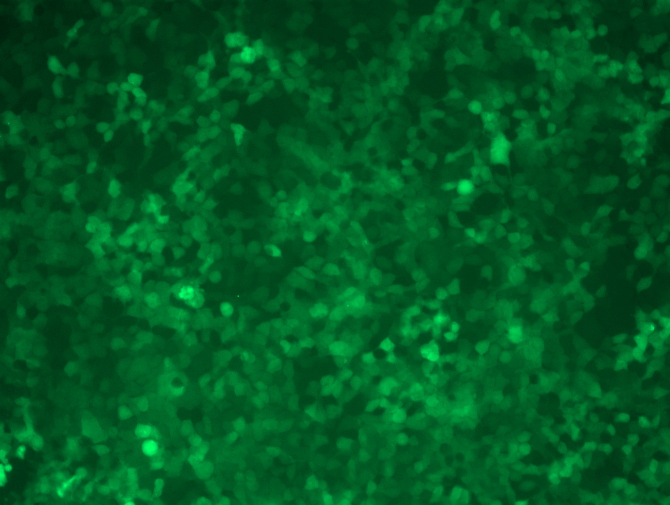 <a href = "https://www.origene.com/catalog/cdna-clones/expression-plasmids/rc208785l4-galectin-3-lgals3-nm-002306-human-tagged-lenti-orf-clone" title="RC208785L4" class="">RC208785L4</a> was used to prepare Lentiviral particles using <a href = "https://www.origene.com/catalog/others/lentiviral-packaging-kits/tr30037-lentiviral-packaging-kits" title="TR30037" class="">TR30037</a> packaging kit. HEK293T cells were transduced with RC208785L4V particle to overexpress human LGALS3-mGFP fusion protein.