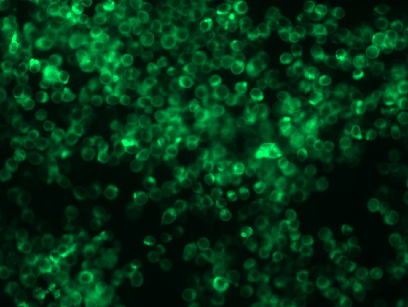 <a href = "https://www.origene.com/catalog/cdna-clones/expression-plasmids/rc208851l2-bcma-tnfrsf17-nm-001192-human-tagged-lenti-orf-clone" title="RC208851L2" class="">RC208851L2</a> was used to prepare Lentiviral particles using <a href = "https://www.origene.com/catalog/others/lentiviral-packaging-kits/tr30037-lentiviral-packaging-kits" title="TR30037" class="">TR30037</a> packaging kit. HEK293T cells were transduced with RC208851L2V particle to overexpress human TNFRSF17-mGFP fusion protein.