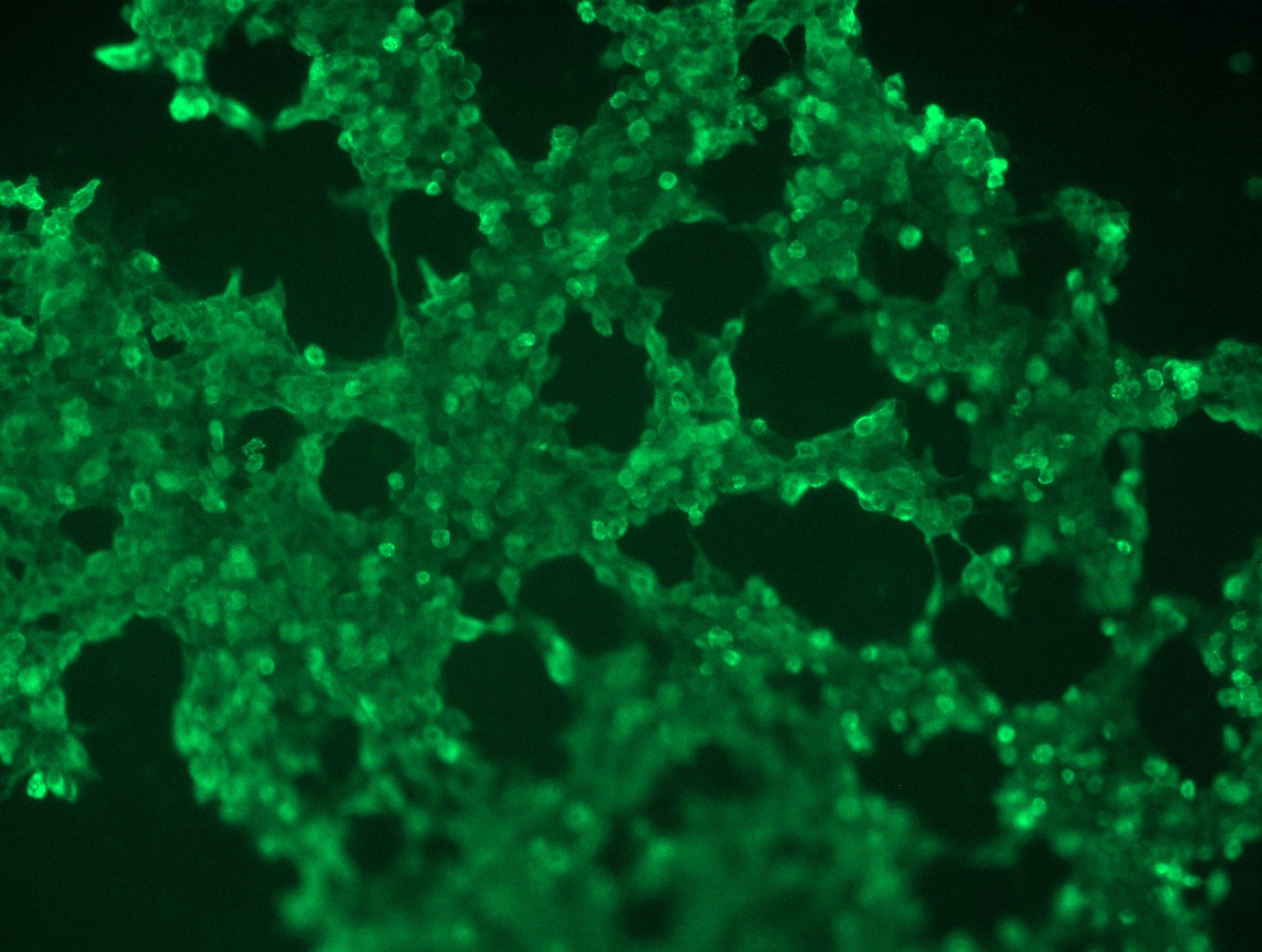 <a href = "https://www.origene.com/catalog/cdna-clones/expression-plasmids/rc208917l3-mmp14-nm-004995-human-tagged-lenti-orf-clone" title="RC208917L3" class="">RC208917L3</a> was used to prepare Lentiviral particles using <a href = "https://www.origene.com/catalog/others/lentiviral-packaging-kits/tr30037-lentiviral-packaging-kits" title="TR30037" class="">TR30037</a> packaging kit. HEK293T cells were transduced with RC208917L3V particle to overexpress human MMP14-Myc-DDK fusion protein.
