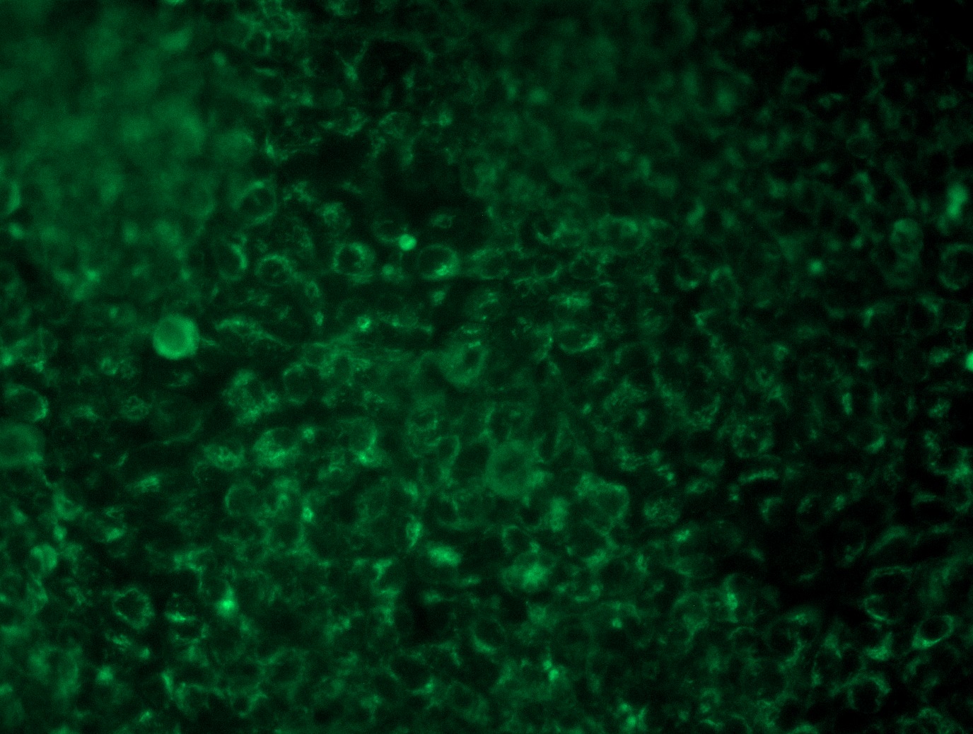 <a href = "https://www.origene.com/catalog/cdna-clones/expression-plasmids/rc209993l3-interferon-gamma-ifng-nm-000619-human-tagged-lenti-orf-clone" title="RC209993L3" class="">RC209993L3</a> was used to prepare Lentiviral particles using <a href = "https://www.origene.com/catalog/others/lentiviral-packaging-kits/tr30037-lentiviral-packaging-kits" title="TR30037" class="">TR30037</a> packaging kit. HEK293T cells were transduced with RC209993L3V particle to overexpress human IFNG-Myc-DDK fusion protein.
