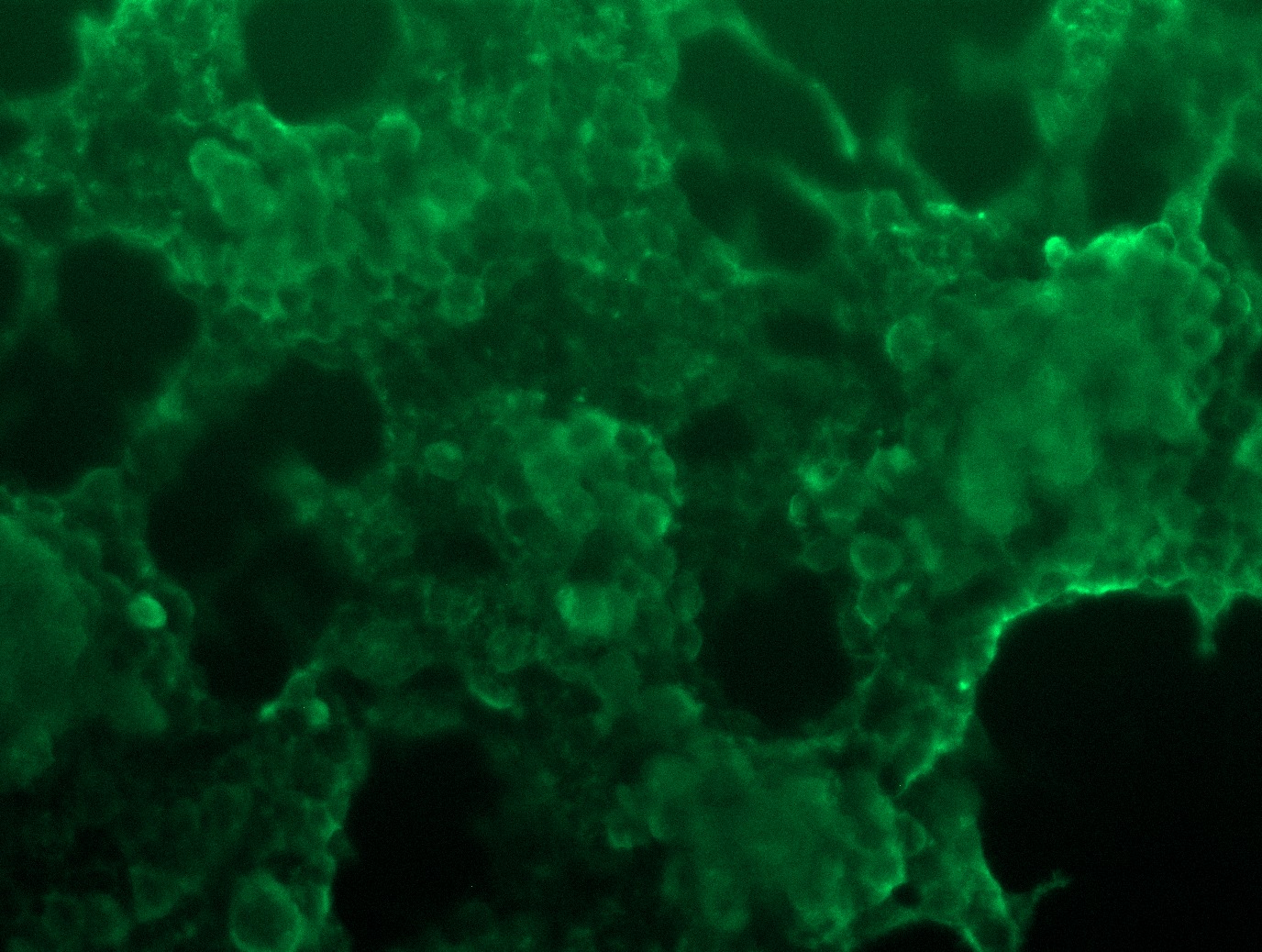 <a href = "https://www.origene.com/catalog/cdna-clones/expression-plasmids/rc210138l3-gprc5d-nm-018654-human-tagged-lenti-orf-clone" title="RC210138L3" class="">RC210138L3</a> was used to prepare Lentiviral particles using <a href = "https://www.origene.com/catalog/others/lentiviral-packaging-kits/tr30037-lentiviral-packaging-kits" title="TR30037" class="">TR30037</a> packaging kit. HEK293T cells were transduced with RC210138L3V particle to overexpress human GPRC5D-Myc-DDK fusion protein.
