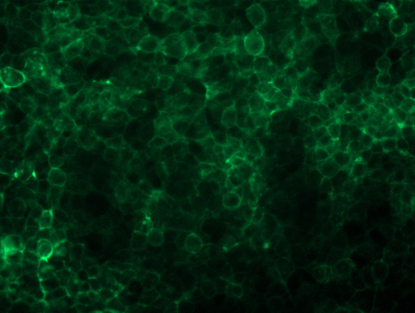 <a href = "https://www.origene.com/catalog/cdna-clones/expression-plasmids/rc210138l4-gprc5d-nm-018654-human-tagged-lenti-orf-clone" title="RC210138L4" class="">RC210138L4</a> was used to prepare Lentiviral particles using <a href = "https://www.origene.com/catalog/others/lentiviral-packaging-kits/tr30037-lentiviral-packaging-kits" title="TR30037" class="">TR30037</a> packaging kit. HEK293T cells were transduced with RC210138L4V particle to overexpress human GPRC5D-mGFP fusion protein.