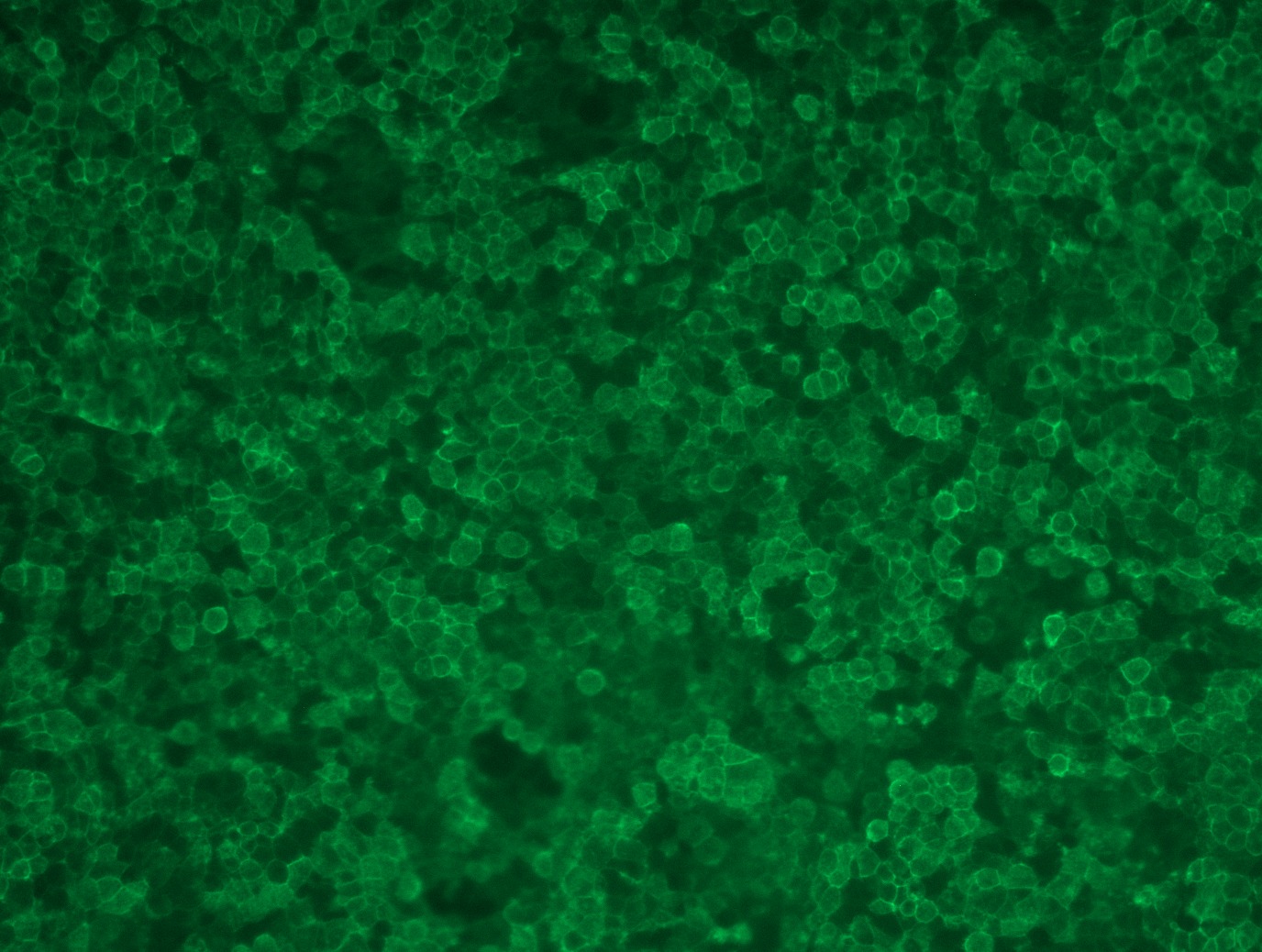 <a href = "https://www.origene.com/catalog/cdna-clones/expression-plasmids/rc210364l3-pd1-pdcd1-nm-005018-human-tagged-lenti-orf-clone" title="RC210364L3" class="">RC210364L3</a> was used to prepare Lentiviral particles using <a href = "https://www.origene.com/catalog/others/lentiviral-packaging-kits/tr30037-lentiviral-packaging-kits" title="TR30037" class="">TR30037</a> packaging kit. HEK293T cells were transduced with RC210364L3V particle to overexpress human PDCD1-Myc-DDK fusion protein.