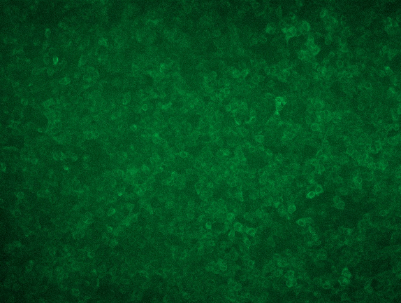 RC210402L1 was used to prepare Lentiviral particles using TR30037 packaging kit. HEK293T cells were transduced with RC210402L1V particle to overexpress human CCN4-Myc-DDK fusion protein.