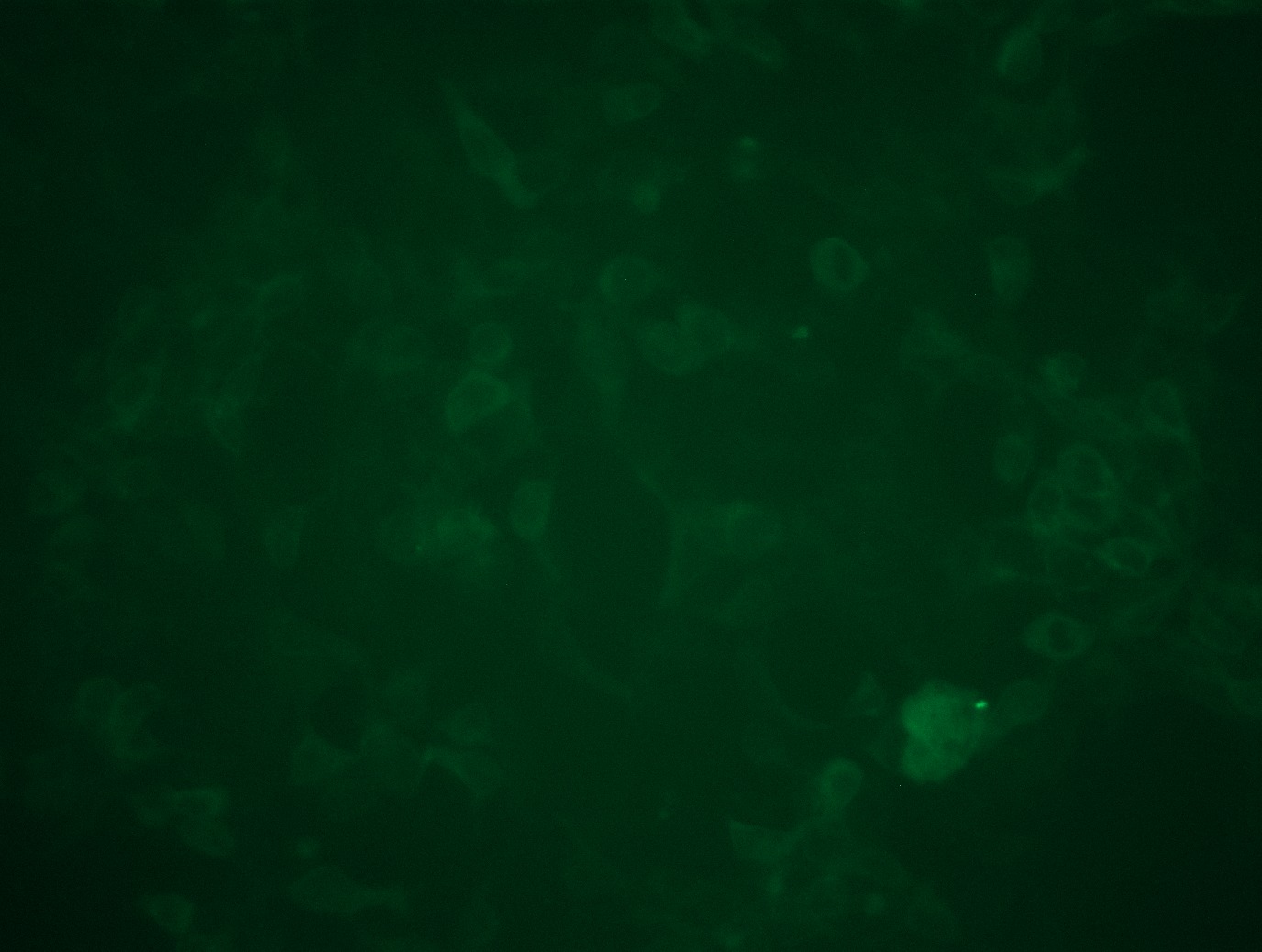 PVRIG (NM_024070) Human Tagged ORF Clone Lentiviral Particle