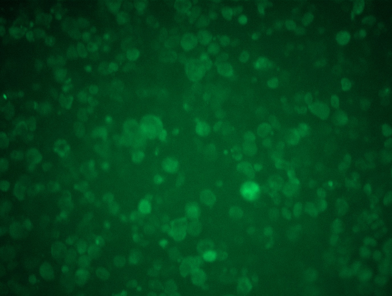<a href = "https://www.origene.com/catalog/cdna-clones/expression-plasmids/rc210639l1-tdp43-tardbp-nm-007375-human-tagged-lenti-orf-clone" title="RC210639L1" class="">RC210639L1</a> was used to prepare Lentiviral particles using <a href = "https://www.origene.com/catalog/others/lentiviral-packaging-kits/tr30037-lentiviral-packaging-kits" title="TR30037" class="">TR30037</a> packaging kit. HEK293T cells were transduced with RC210639L1V particle to overexpress human TARDBP-Myc-DDK fusion protein.