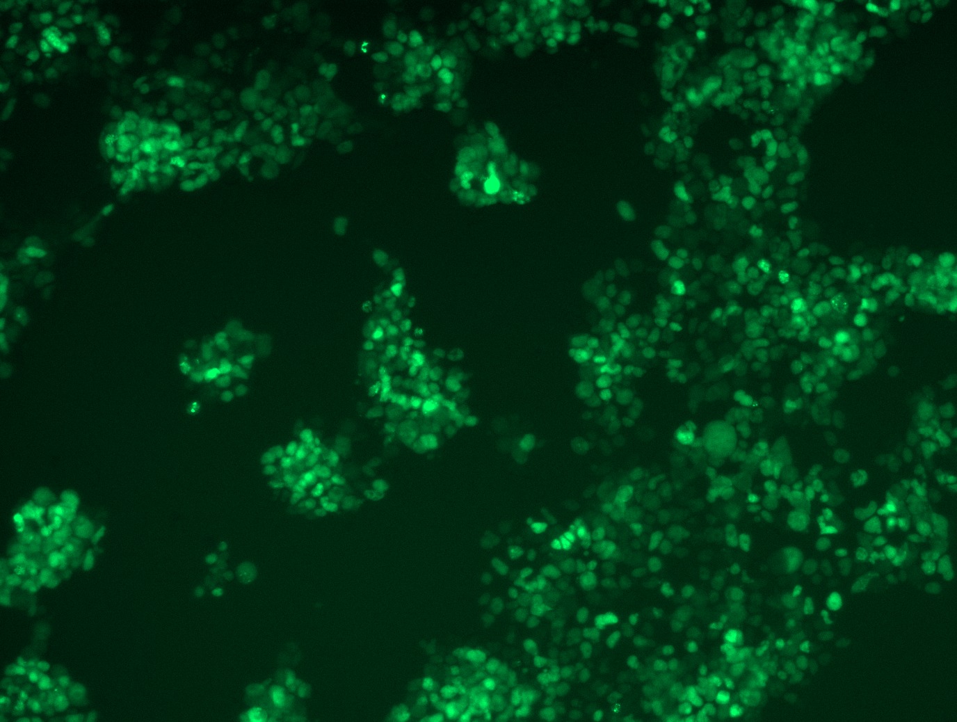 <a href = "https://www.origene.com/catalog/cdna-clones/expression-plasmids/rc210639l2-tdp43-tardbp-nm-007375-human-tagged-lenti-orf-clone" title="RC210639L2" class="">RC210639L2</a> was used to prepare Lentiviral particles using <a href = "https://www.origene.com/catalog/others/lentiviral-packaging-kits/tr30037-lentiviral-packaging-kits" title="TR30037" class="">TR30037</a> packaging kit. HEK293T cells were transduced with RC210639L2V particle to overexpress human TARDBP-mGFP fusion protein.