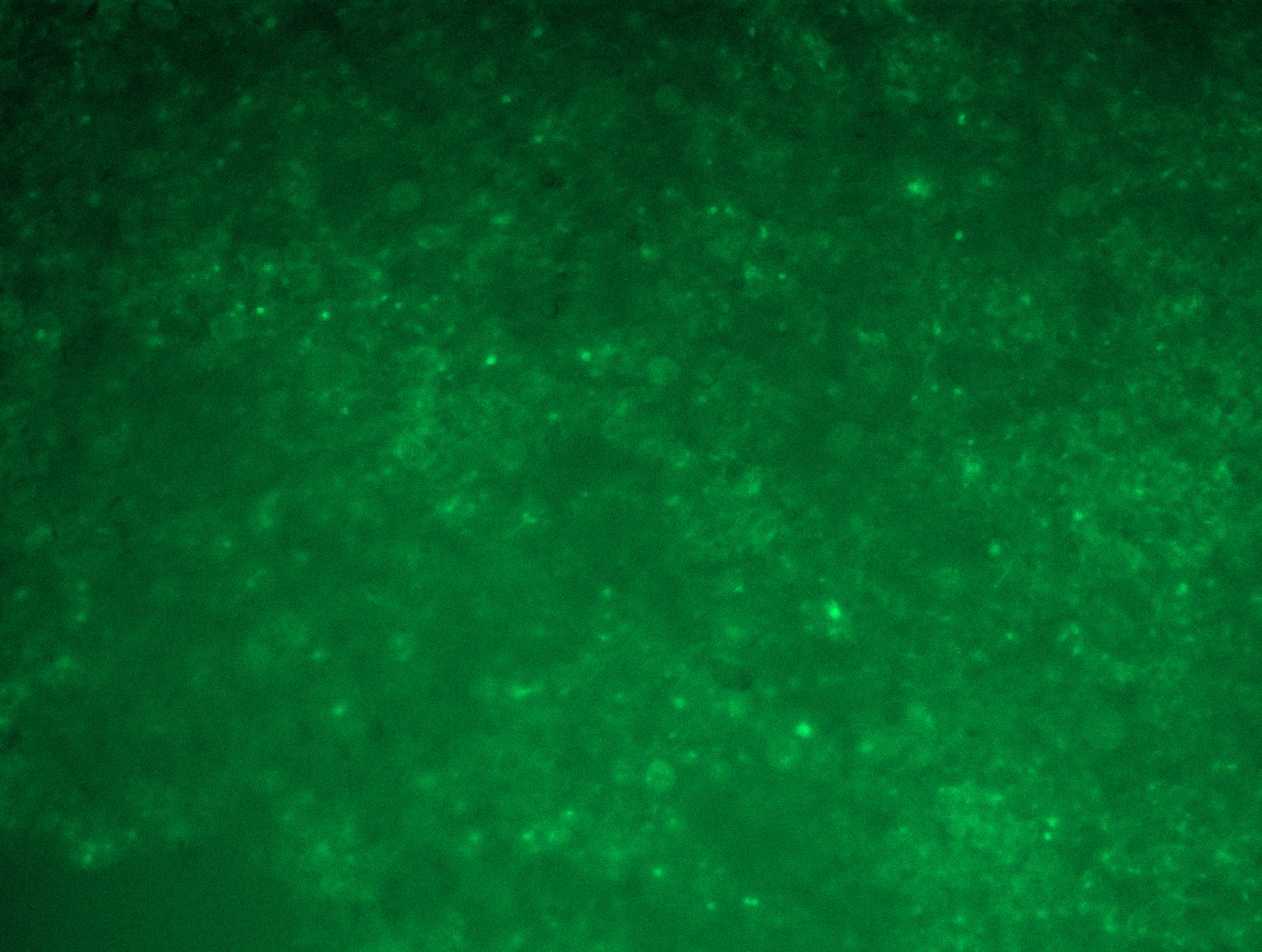 MS4A6A (NM_022349) Human Tagged ORF Clone Lentiviral Particle
