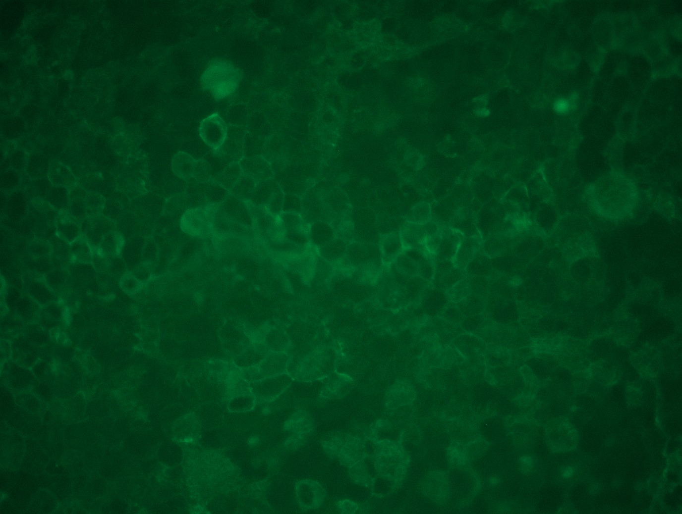 <a href = "https://www.origene.com/catalog/cdna-clones/expression-plasmids/rc211228l3-lilrb3-nm-006864-human-tagged-lenti-orf-clone" title="RC211228L3" class="">RC211228L3</a> was used to prepare Lentiviral particles using <a href = "https://www.origene.com/catalog/others/lentiviral-packaging-kits/tr30037-lentiviral-packaging-kits" title="TR30037" class="">TR30037</a> packaging kit. HEK293T cells were transduced with RC211228L3V particle to overexpress human LILRB3-Myc-DDK fusion protein.