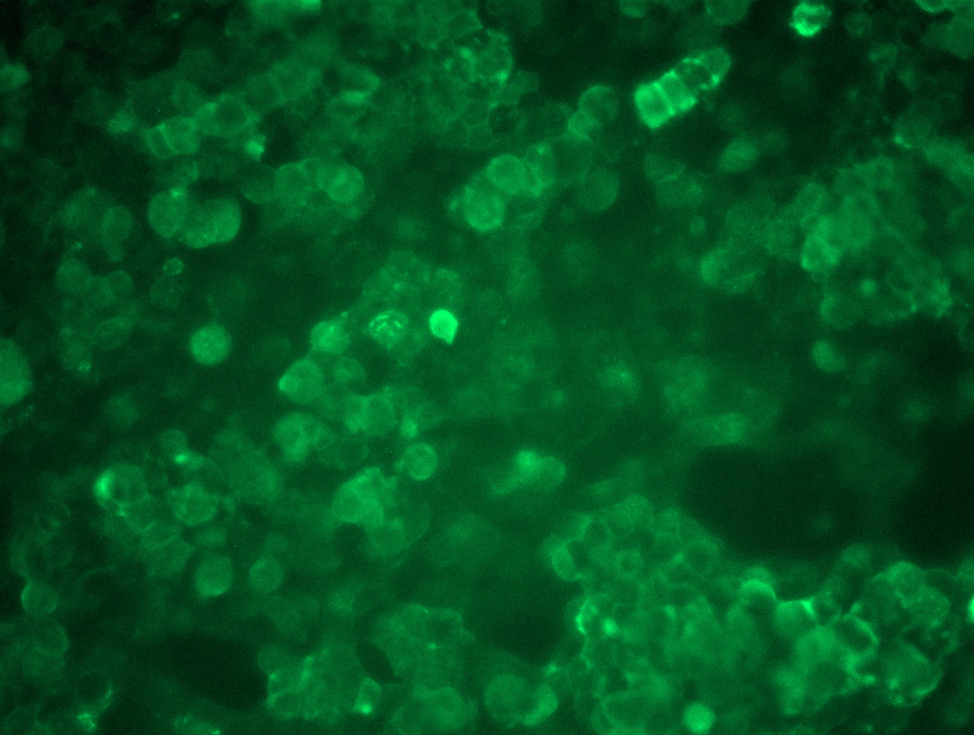 <a href = "https://www.origene.com/catalog/cdna-clones/expression-plasmids/rc211318l1-cd28-nm-006139-human-tagged-lenti-orf-clone" title="RC211318L1" class="">RC211318L1</a> was used to prepare Lentiviral particles using <a href = "https://www.origene.com/catalog/others/lentiviral-packaging-kits/tr30037-lentiviral-packaging-kits" title="TR30037" class="">TR30037</a> packaging kit. HEK293T cells were transduced with RC211318L1V particle to overexpress human CD28-Myc-DDK fusion protein.