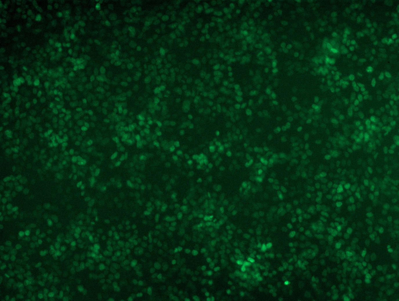 <a href = "https://www.origene.com/catalog/cdna-clones/expression-plasmids/rc211408l4-foxa2-nm-153675-human-tagged-lenti-orf-clone" title="RC211408L4" class="">RC211408L4</a> was used to prepare Lentiviral particles using <a href = "https://www.origene.com/catalog/others/lentiviral-packaging-kits/tr30037-lentiviral-packaging-kits" title="TR30037" class="">TR30037</a> packaging kit. HEK293T cells were transduced with RC211408L4V particle to overexpress human FOXA2-mGFP fusion protein.