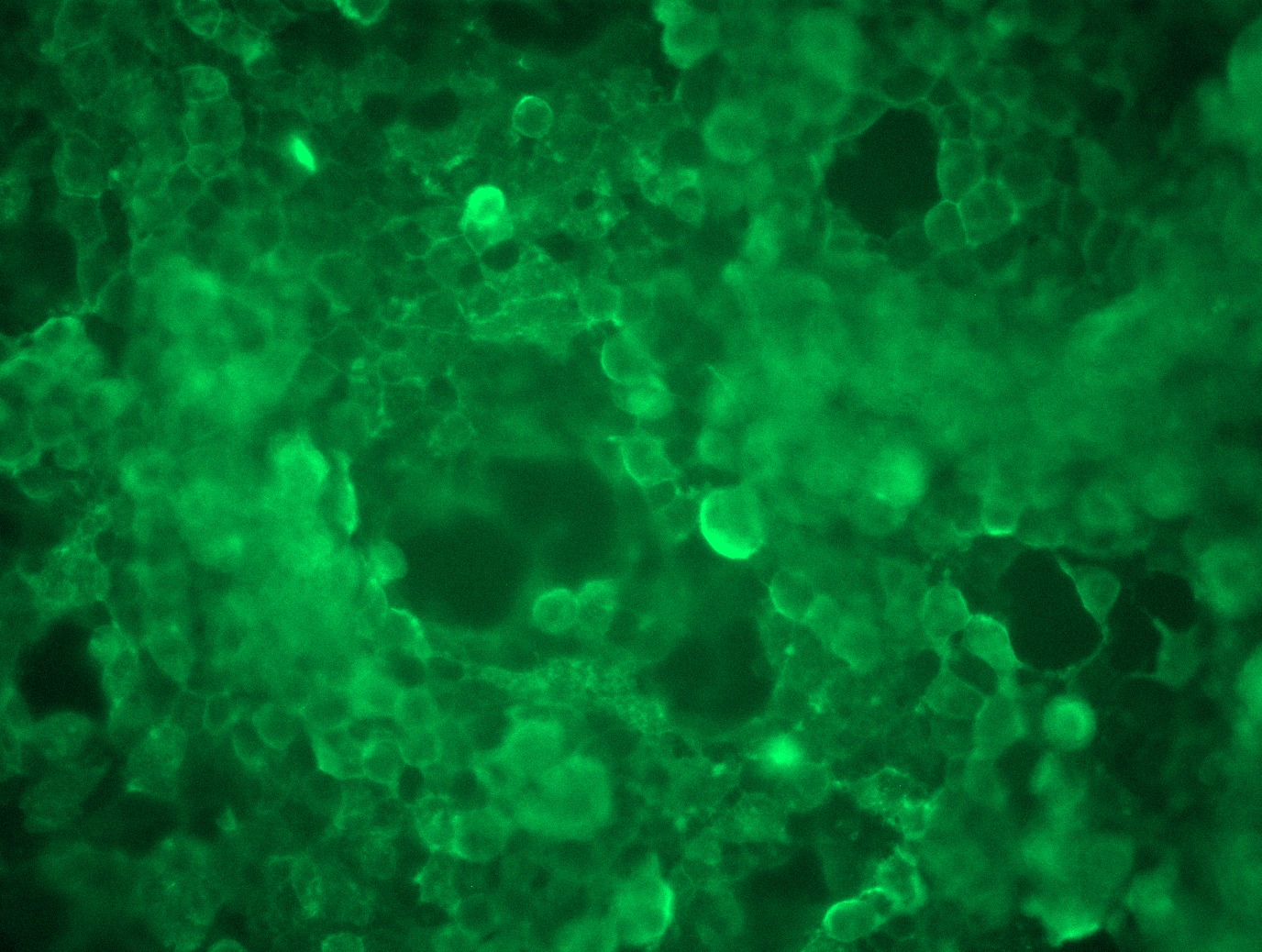 RC211970L3 was used to prepare Lentiviral particles using TR30037 packaging kit. HEK293T cells were transduced with RC211970L3V particle to overexpress human IL1RAP-Myc-DDK fusion protein.