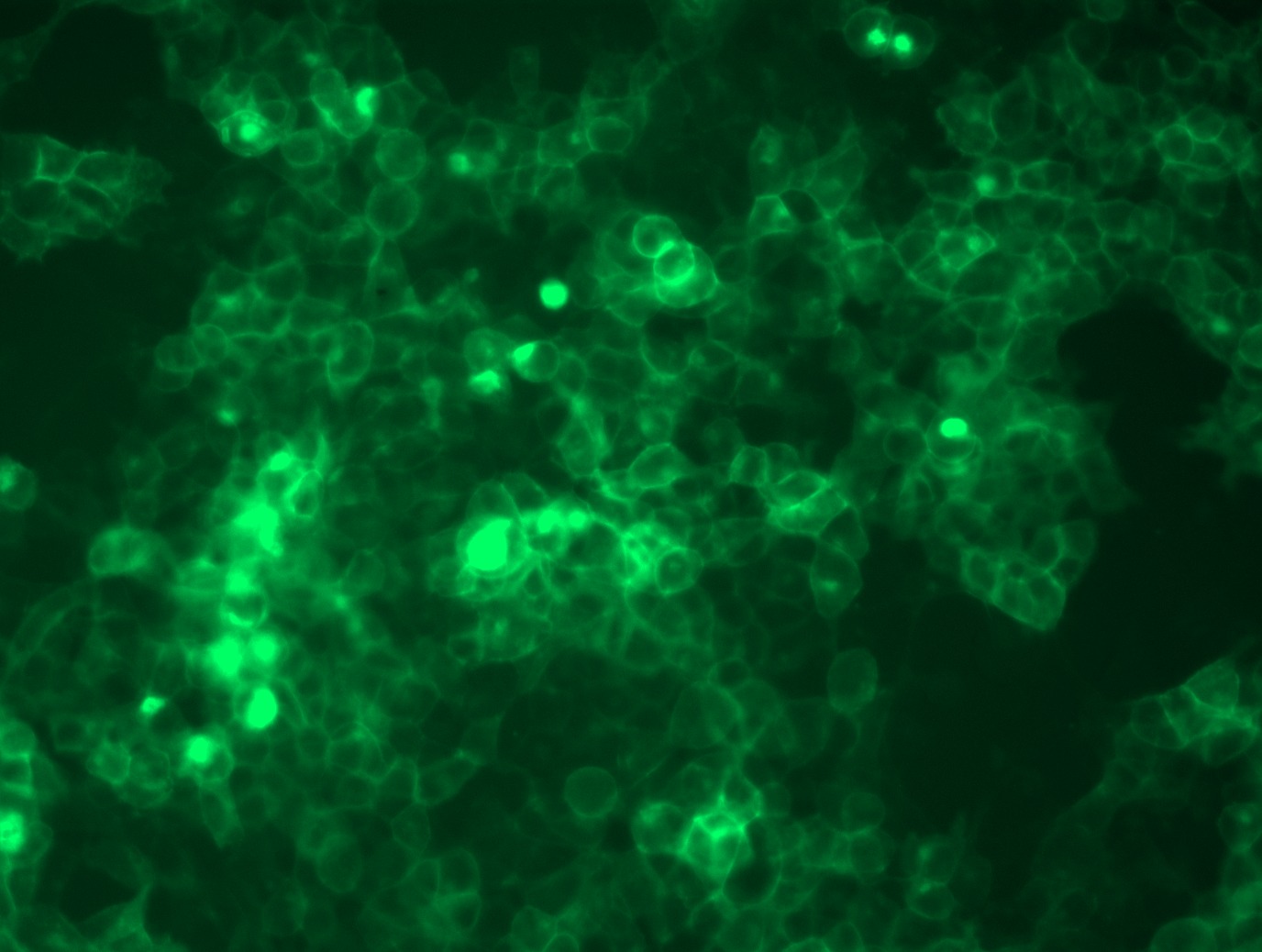 <a href = "https://www.origene.com/catalog/cdna-clones/expression-plasmids/rc212006l4-pigr-nm-002644-human-tagged-lenti-orf-clone" title="RC212006L4" class="">RC212006L4</a> was used to prepare Lentiviral particles using <a href = "https://www.origene.com/catalog/others/lentiviral-packaging-kits/tr30037-lentiviral-packaging-kits" title="TR30037" class="">TR30037</a> packaging kit. HEK293T cells were transduced with RC212006L4V particle to overexpress human PIGR-mGFP fusion protein.