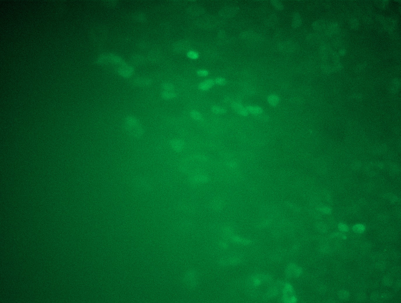 <a href = "https://www.origene.com/catalog/cdna-clones/expression-plasmids/rc212391l3-msh3-nm-002439-human-tagged-lenti-orf-clone" title="RC212391L3" class="">RC212391L3</a> was used to prepare Lentiviral particles using <a href = "https://www.origene.com/catalog/others/lentiviral-packaging-kits/tr30037-lentiviral-packaging-kits" title="TR30037" class="">TR30037</a> packaging kit. HEK293T cells were transduced with RC212391L3V particle to overexpress human MSH3-Myc-DDK fusion protein.