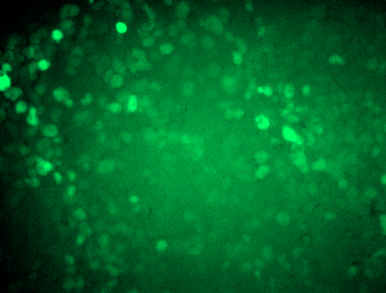 RC212391L4V was used to prepare Lentiviral particles using <a href = "https://www.origene.com/catalog/others/lentiviral-packaging-kits/tr30037-lentiviral-packaging-kits" title="TR30037" class="">TR30037</a> packaging kit. HEK293T cells were transduced with RC212391L4V particles to overexpress human MSH3-mGFP fusion protein.