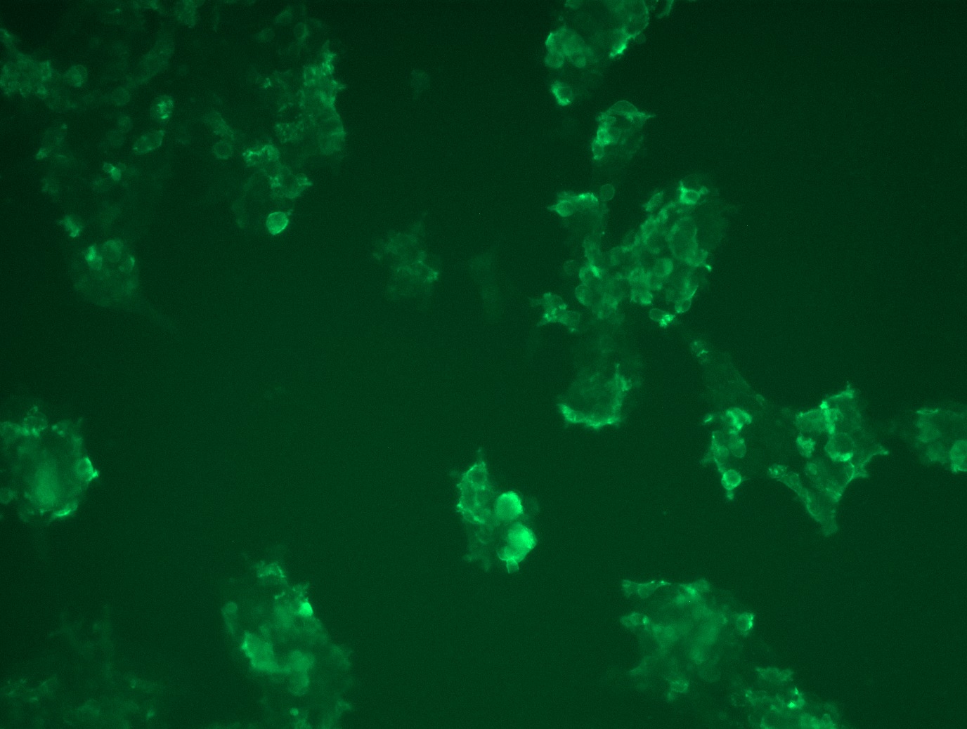 <a href = "https://www.origene.com/catalog/cdna-clones/expression-plasmids/rc212583l1-her2-erbb2-nm-004448-human-tagged-lenti-orf-clone" title="RC212583L1" class="">RC212583L1</a> was used to prepare Lentiviral particles using <a href = "https://www.origene.com/catalog/others/lentiviral-packaging-kits/tr30037-lentiviral-packaging-kits" title="TR30037" class="">TR30037</a> packaging kit. HEK293T cells were transduced with RC212583L1V particle to overexpress human ERBB2-Myc-DDK fusion protein.