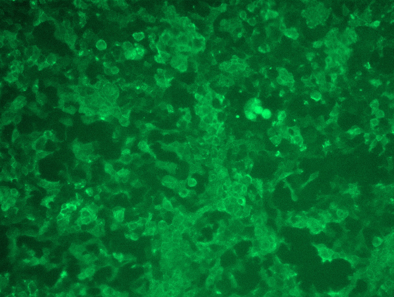 <a href = "https://www.origene.com/catalog/cdna-clones/expression-plasmids/rc212583l3-her2-erbb2-nm-004448-human-tagged-lenti-orf-clone" title="RC212583L3" class="">RC212583L3</a> was used to prepare Lentiviral particles using <a href = "https://www.origene.com/catalog/others/lentiviral-packaging-kits/tr30037-lentiviral-packaging-kits" title="TR30037" class="">TR30037</a> packaging kit. HEK293T cells were transduced with RC212583L3V particle to overexpress human ERBB2-Myc-DDK fusion protein.