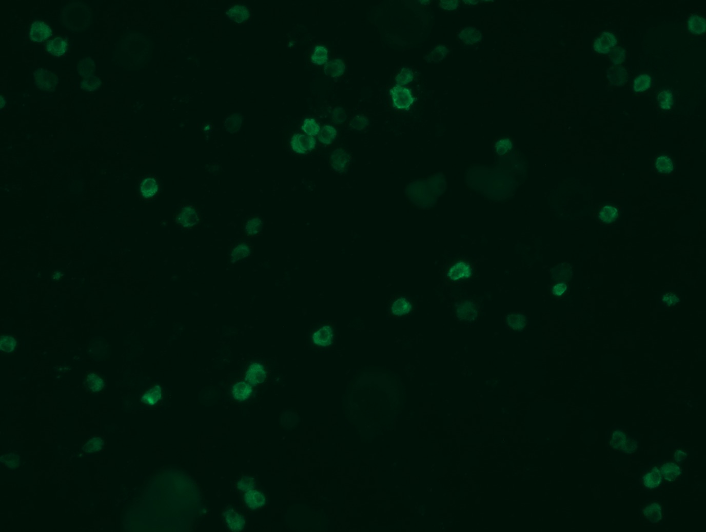 <a href = "https://www.origene.com/catalog/cdna-clones/expression-plasmids/rc213071l3-pd-l1-cd274-nm-014143-human-tagged-lenti-orf-clone" title="RC213071L3" class="">RC213071L3</a> was used to prepare Lentiviral particles using <a href = "https://www.origene.com/catalog/others/lentiviral-packaging-kits/tr30037-lentiviral-packaging-kits" title="TR30037" class="">TR30037</a> packaging kit. HEK293T cells were transduced with RC213071L3V particle to overexpress human CD274-Myc-DDK fusion protein.