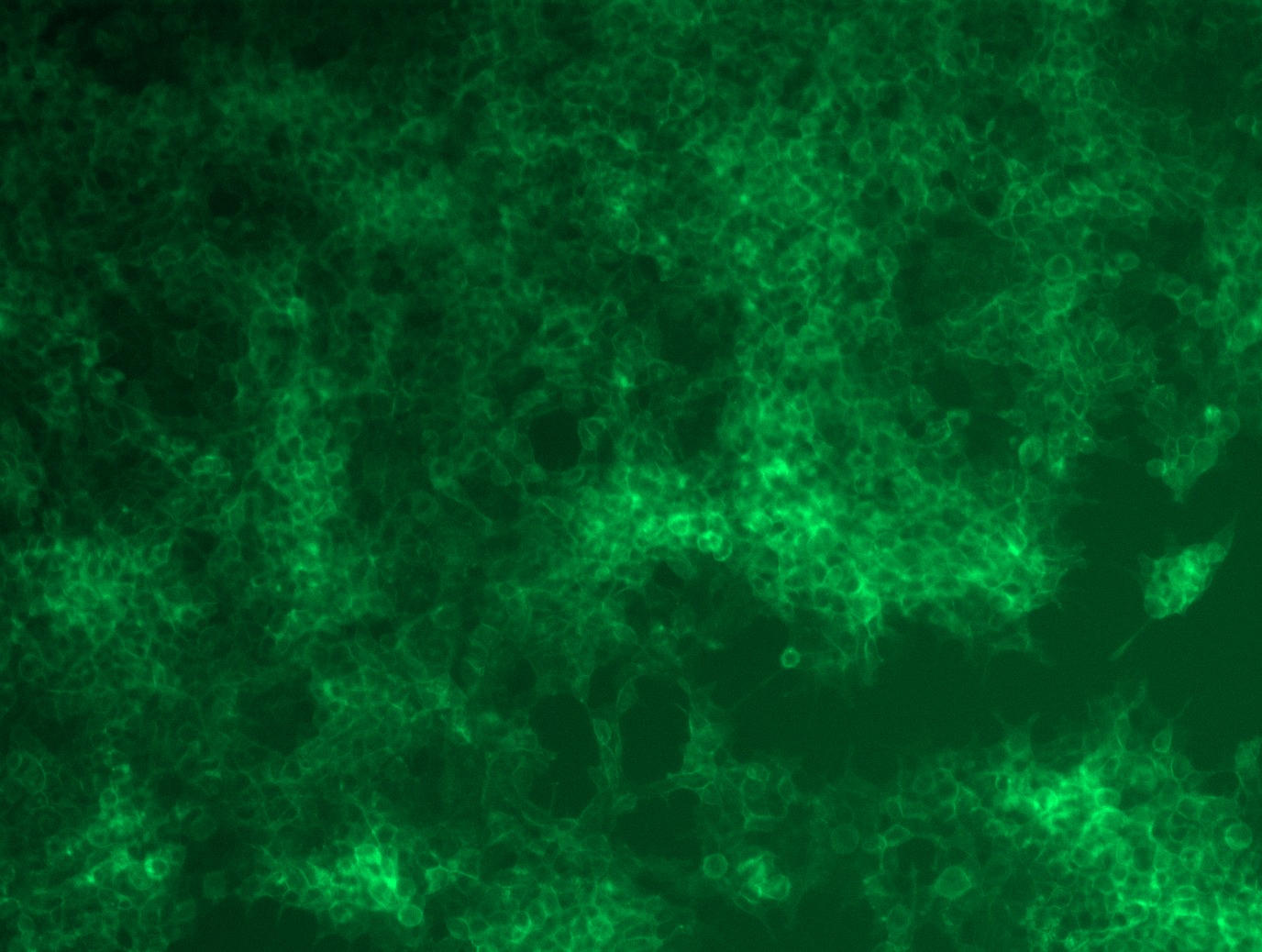 <a href = "https://www.origene.com/catalog/cdna-clones/expression-plasmids/rc213071l4-pd-l1-cd274-nm-014143-human-tagged-lenti-orf-clone" title="RC213071L4" class="">RC213071L4</a> was used to prepare Lentiviral particles using <a href = "https://www.origene.com/catalog/others/lentiviral-packaging-kits/tr30037-lentiviral-packaging-kits" title="TR30037" class="">TR30037</a> packaging kit. HEK293T cells were transduced with RC213071L4V particle to overexpress human CD274-mGFP fusion protein.